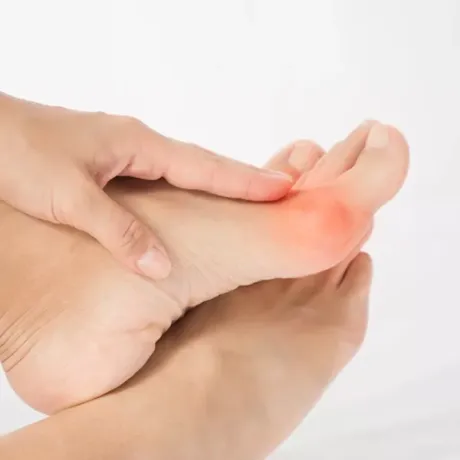 Rééducation Hallux Valgus : Louez l'Attelle Hall-U-Sana